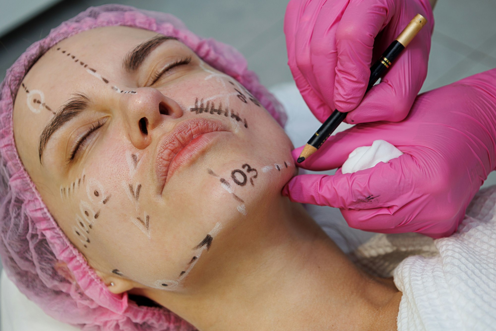 Woman lining the face of young girl with pencil, doing future surgical operations