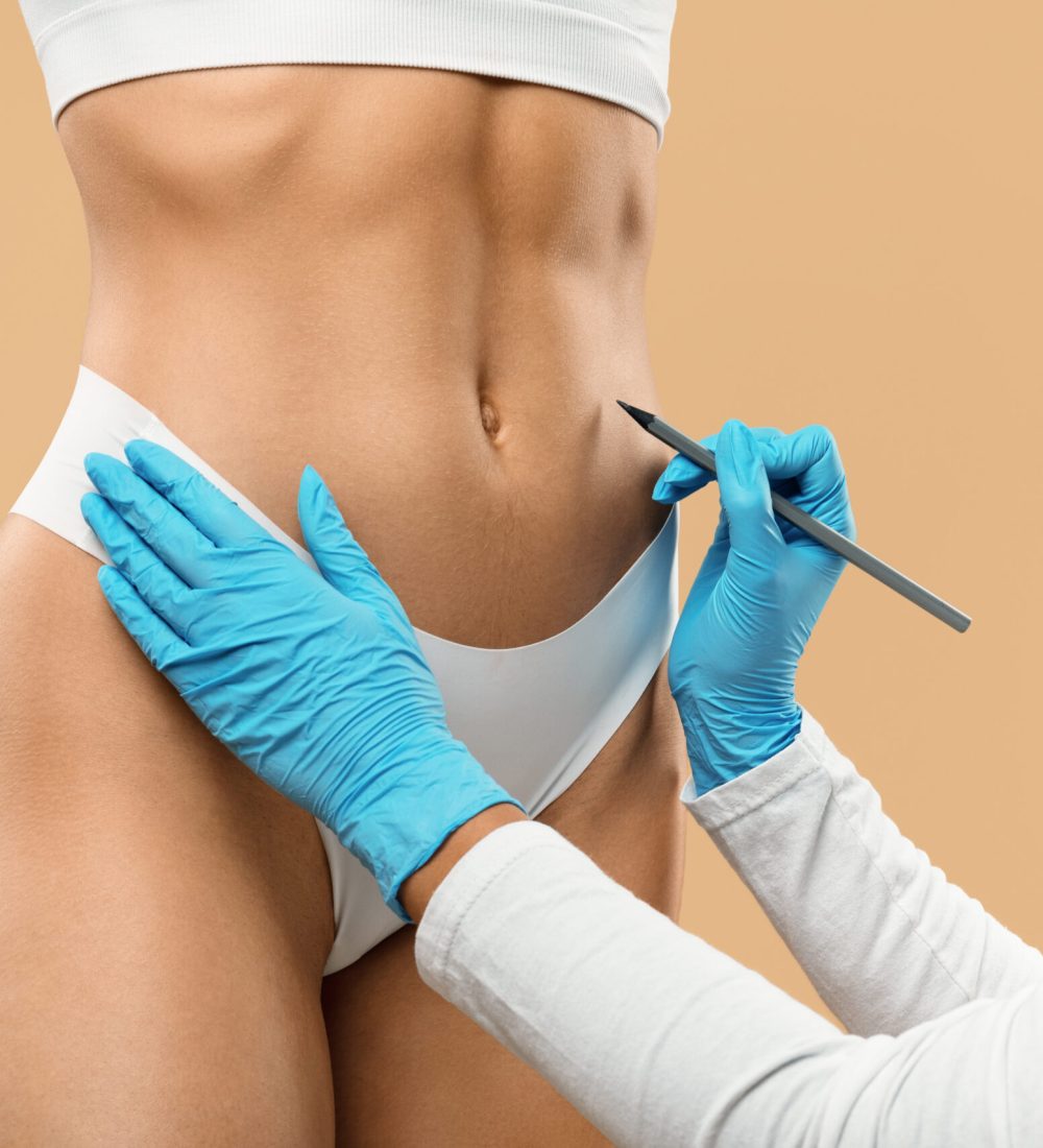 Doctor drawing marks on female stomach, preparing for cosmetic surgery operation isolated on beige studio background, young lady getting ready for aesthetic correction procedure, lipolysis