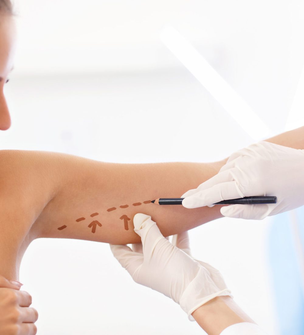 Picture of plastic plastic surgeon making marks on patient's body