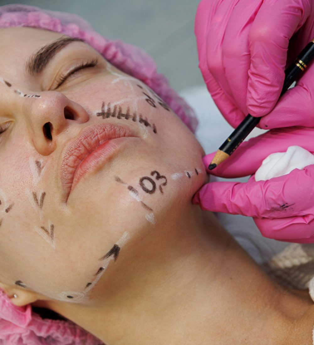 Woman lining the face of young girl with pencil, doing future surgical operations